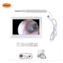 Ear Inspection Camera with 6 LEDs Lights Ear Wax Removal Tool Rechargeable Battery Digital Otoscope with 4.3inche